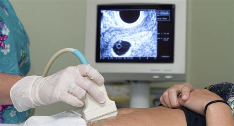 dating pregnancy using ultrasound